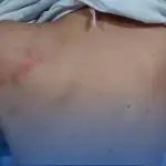 MÃE AGRIDE FILHA DE 6 ANOS COM MANGUEIRA POR NÃO FAZER LIÇÃO DA ESCOLA.