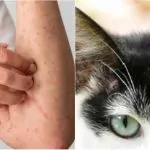 ALERTA EM SANTA CATARINA: DOENÇA TRANSMITIDA POR GATOS JÁ ATINGIU PESSOAS E ACENDE SINAL DE PREOCUPAÇÃO.